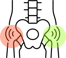 Illustration of a human pelvis with highlighted areas on a white background