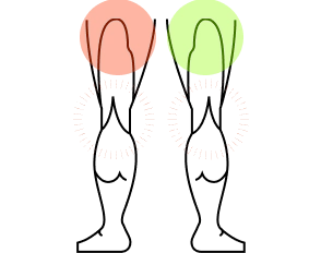 Illustration of a person's legs with red and green patches on a white background